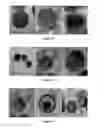 Fig. 09 - SiO-layered double hydroxide microspheres and methods of making them
