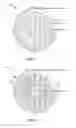 Fig. 03 - Apparatus and method for forming nanoparticles