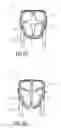 Fig. 08 - Headrest body and headrest