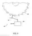 Fig. 07 - Restraint system