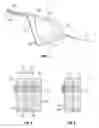 Fig. 05 - Body-mounted tire blocker assembly