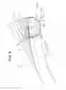 Fig. 09 - Elastic crawler and elastic crawler drive mechanism