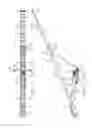 Fig. 02 - Tracked radial stacker with wheels