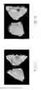 Fig. 03 - High-magnesium concentrated liquid