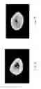 Fig. 07 - High-magnesium concentrated liquid