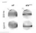 Fig. 45 - Polypeptides, nucleic acids and uses thereof