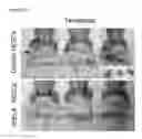 Fig. 64 - Polypeptides, nucleic acids and uses thereof