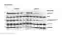 Fig. 87 - Polypeptides, nucleic acids and uses thereof