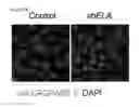 Fig. 97 - Polypeptides, nucleic acids and uses thereof
