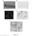 Fig. 02 - Antibodies to oxidized phospholipids