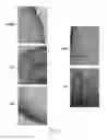 Fig. 09 - High efficiency library-identified AAV vectors