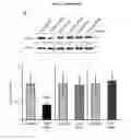 Fig. 04 - Genetic or pharmacological reduction of PERK enhances cortical- and hippocampus-dependent cognitive function