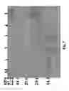 Fig. 08 - Methods for improving expression levels of foreign proteins by means of phospholipase fusion expression