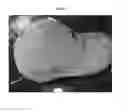Fig. 09 - TEXTILE FABRIC, METHOD OF MANUFACTURING THE SAME AND TEXTILE PRODUCT MANUFACTURED USING THE SAME
