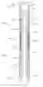 Fig. 02 - Resin system for composite downhole frac plug and bridge plug tools and related methods