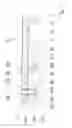 Fig. 02 - Lubricating device for a transmission, and transmission comprising said lubricating device