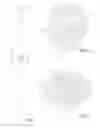 Fig. 04 - DRINKING STRAW DIAPHRAGM