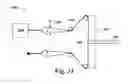 Fig. 18 - Tension measuring device