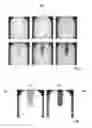 Fig. 07 - Method and device for detecting an analyte in a body fluid