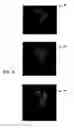 Fig. 08 - Imaging system and method with scatter correction
