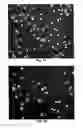 Fig. 02 - Method of culturing spirochetes and of diagnosing infections, and a diagnostic kit for use in the methods