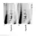 Fig. 07 - METHOD OF IDENTIFYING BIOMARKERS OF NEUROLOGICAL DISEASES AND DIAGNOSIS OF NEUROLOGICAL DISEASES