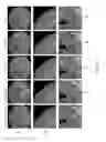Fig. 08 - Denoising medical images by learning sparse image representations with a deep unfolding approach using scan specific metadata