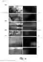 Fig. 07 - Digital image defect identification and correction
