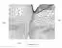 Fig. 01 - Method for reconstructing joined part surfaces of two adjacent teeth of a 3D digital model of teeth