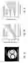 Fig. 08 - Quantification of magnetic resonance data by adaptive fitting of downsampled images
