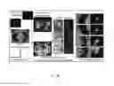 Fig. 04 - Eye tracking applications in computer aided diagnosis and image processing in radiology