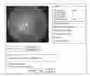 Fig. 01 - System and method to teach and evaluate image grading performance using prior learned expert knowledge base