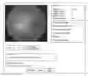 Fig. 01 - System and method to teach and evaluate image grading performance using prior learned expert knowledge base