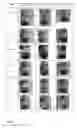 Fig. 03 - Functionalized magnetic nanoparticles and a method for preparation thereof