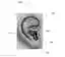 Fig. 01 - Personal hearing device
