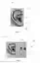Fig. 02 - Personal hearing device