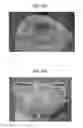 Fig. 09 - DEVICE FOR VASCULARIZED COMPOSITE ALLOTRANSPLANT PRESERVATION AND USE THEREOF