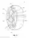 Fig. 02 - VENTED RING AND METHOD