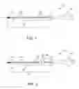 Fig. 02 - Device for measuring length of tubular body structure