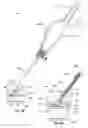 Fig. 09 - VASCULAR SENSOR IMPLANTATION DEVICES AND METHODS
