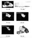 Fig. 17 - System and method for optimized mass spectrometry analysis