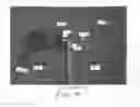 Fig. 02 - DEVICES AND METHODS FOR USE IN PERFORMING ARTHROSCOPIC TOTAL SHOULDER REPLACEMENT