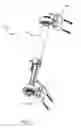 Fig. 22 - External fixation