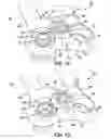Fig. 07 - Internal fixation devices with rotatable screw locks