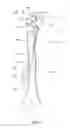Fig. 02 - Devices and methods for repairing bone fractures