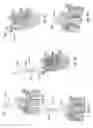 Fig. 06 - Patient-matched apparatus and methods for performing surgical procedures
