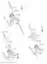Fig. 07 - Patient-matched apparatus and methods for performing surgical procedures