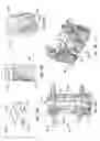 Fig. 16 - Patient-matched apparatus and methods for performing surgical procedures