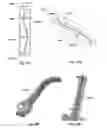 Fig. 41 - Patient-matched apparatus and methods for performing surgical procedures