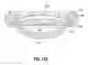 Fig. 35 - Accommodating intraocular lens device